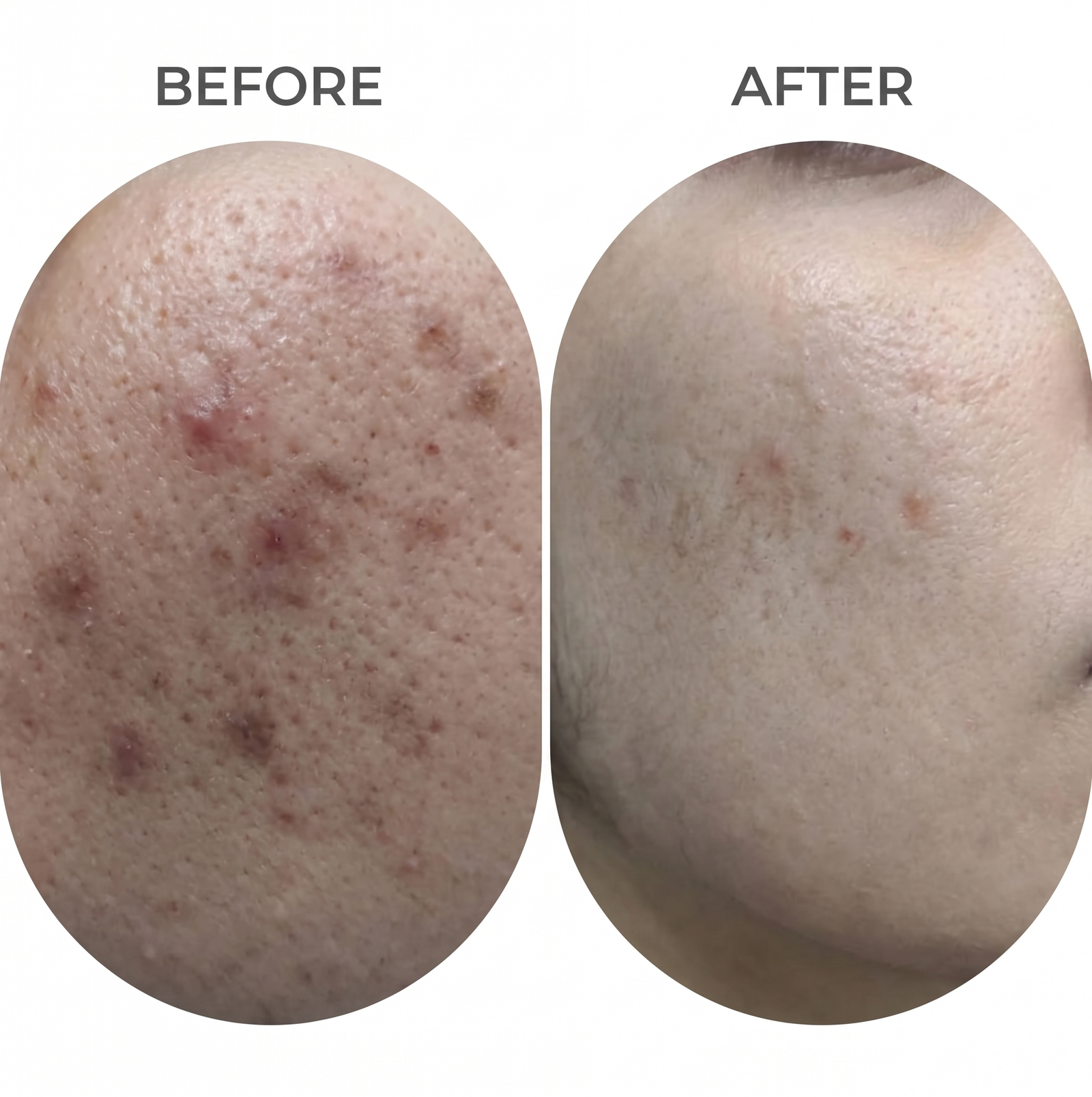 Patient Results